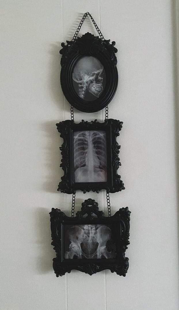 Framed Skeleton X-Ray Wall Trio